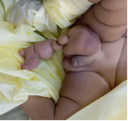 Sudan-Al-Jakayka-Hospital-surgery